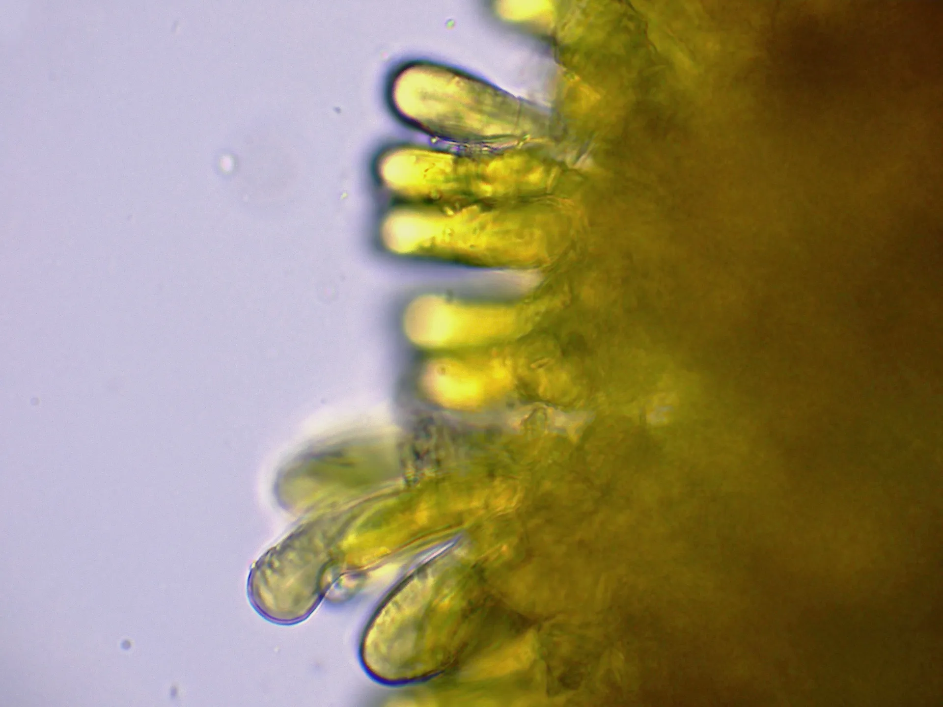 10 - Suprapellis agua -002